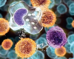 inflammation