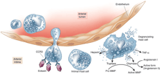 inflammation